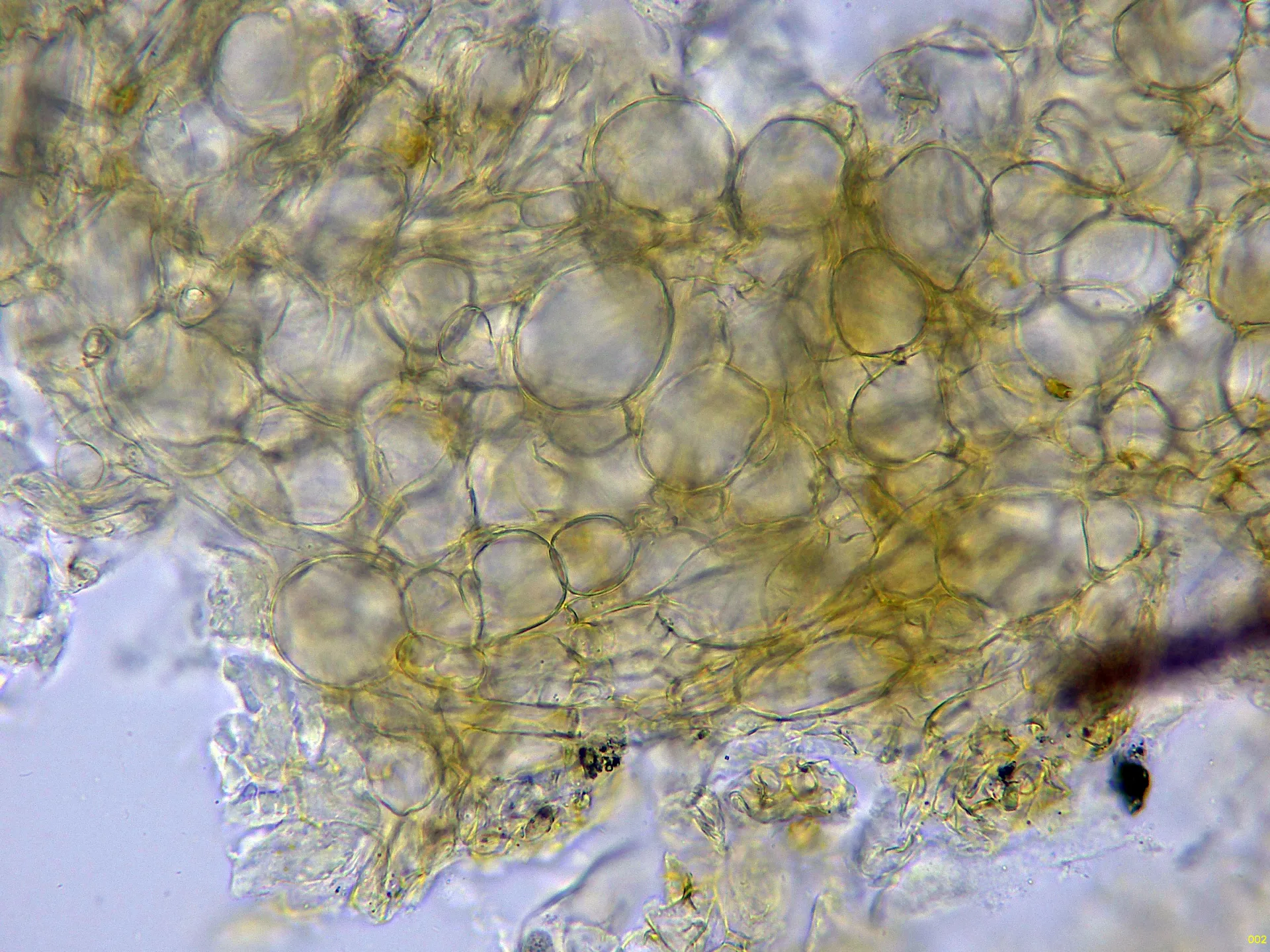 Microscopía de Paragalactinia michelii - 10 - Excípulo externo agua x 400-002